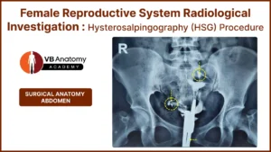 Hysterosalpingography (HSG) Procedure: Explore the Female Reproductive System