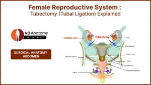 Tubectomy (Tubal Ligation) Explained
